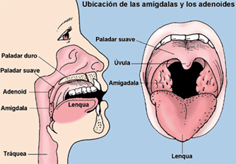 adenoides1